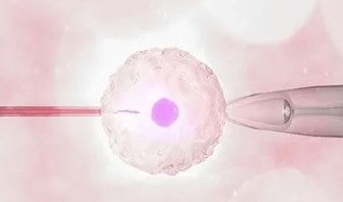 多囊卵巢综合征真的很严重吗?可以做试管吗?